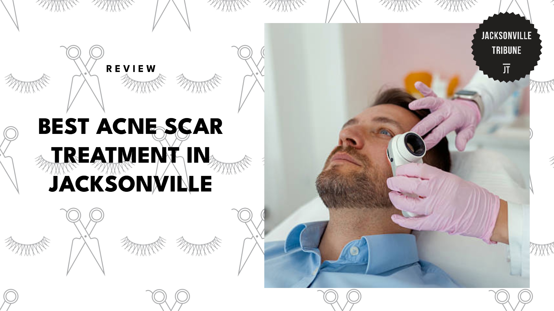 best-acne-scar-treatment-jacksonville-banner
